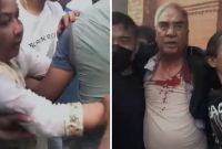 पूर्वप्रधानमन्त्री देउवा दम्पती कुटपिट!